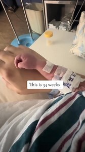 A 34-week baby is fully formed — breathing, reacting, and fighting for life in the NICU. Now imagine this same age being legally terminated in a clinic down the road. Two new U.S. facilities are offering abortions up to 34 weeks, a stage where survival rates in NICUs are extremely high. Only 1.1% of abortions occur this late, but the fact that any do — at a stage of clear viability — should alarm every human being with a conscience. This isn’t a political argument. It’s a reality check. If a bab