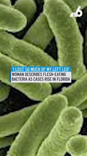 Woman describes flesh-eating bacteria as cases rise in Florida
