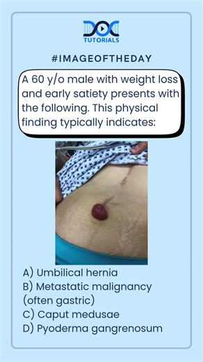 Can You Identify This Sign? | NEET PG Image-Based MCQ
