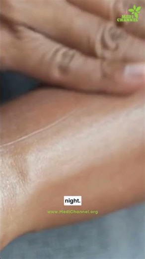 Why Your Skin Feels Itchy at Night – 3 Surprising Reasons