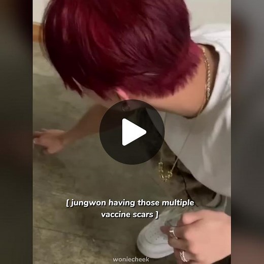 jungwon is still a baby, because he has this multiple vaccine scar. #enhypen #jungwon #yangjungwon #engene #kpop #kpopfyp #fyp #foryoupage #fypシ