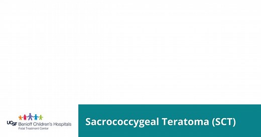 Sacrococcygeal Teratoma (SCT)