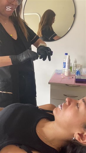 #acidohialuronico #plasmaricoenplaquetas #botox #xeomin #prophilo #harmonyca #radiesse #hilostensoresfaciales #blanquamientodental