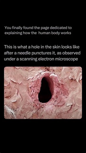 The Human Body 🧬 on Instagram: "Follow @explainingthebody to learn everything about the human body one post at a time 🧠⚙️ When a needle pierces your skin for an injection or a blood draw, it creates a minuscule injury, and what the remaining hole looks like under a Scanning Electron Microscope (SEM) is truly astonishing. Instead of a clean, laser-like cut, the needle pushes and tears through the skin’s toughest layer, the epidermis. The SEM image reveals the wound’s ragged, stretched-out edges