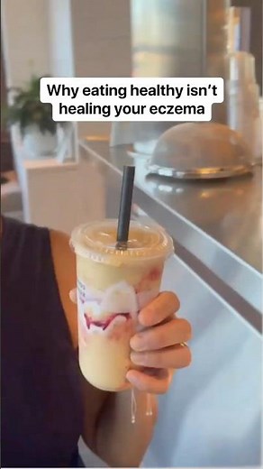 Why eating healthy isn’t healing your eczema