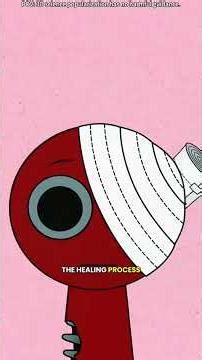 大脑被打开时，医生是怎么把肿瘤‘拿’出来的？|直击手术现场：4K高清动画还原脑肿瘤切除全过程|揭秘脑肿瘤切除术。