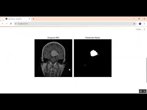 Brain MRI image Segmentation in Python Projects
