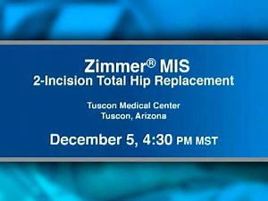 Podcast: Zimmer MIS 2-Incision Total Hip Replacement...
