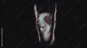 Voluminous color CT scan of the abdomen. Computed tomography of the gastrointestinal tract, liver and kidneys