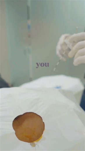 Epidural injections are used to reduce nerve inflammation in the spine — often from disc issues or arthritis. They’re not a cure, but they lower pain enough to let you move, exercise, and start physical therapy. That’s how real recovery starts. #painmanagement #painrelief #backpain | Precision Care Medical & Sports Performance