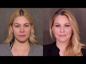 How Supermodel Shanna Moakler Keeps Her Face Looking Young