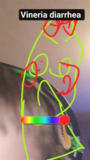 vineria has explosive diarrhea because she was eating taco bell