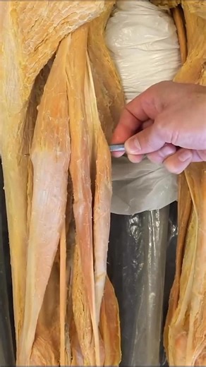 Dr. Tom Walters, DPT, OCS on Instagram: "💥𝐇𝐚𝐦𝐬𝐭𝐫𝐢𝐧𝐠 𝐀𝐧𝐚𝐭𝐨𝐦𝐲💥 —— 👉Today’s video from @instituteofhumananatomy gives a beneath the skin view of the hamstring muscle group! 📚The hamstring muscles (biceps femoris, semimembranosus, and semitendinosus) run along the posterior thigh and act to flex (bend) the knee and extend the hip. 🔎Because the hamstrings serve as antagonists to the quadriceps, they are vitally important in terms of knee stability and overall lower extremity cont