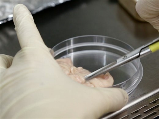 Vidéo: Coloration au bleu d’Alcian pour visualiser les protéoglycanes : une technique pour détecter les protéoglycanes dans la culture de chondrocytes différenciés de cellules souches mésenchymateuses in vitro - Expérience