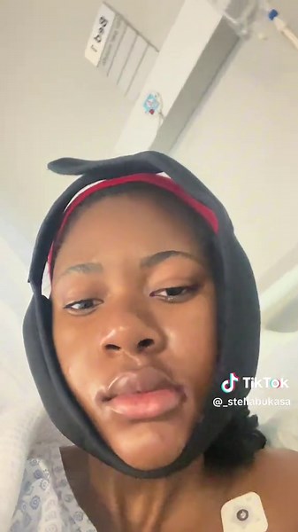 Wisdom Teeth Removal Experience and Recovery Tips