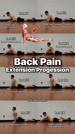 Back Pain Relief - Extension Exercises