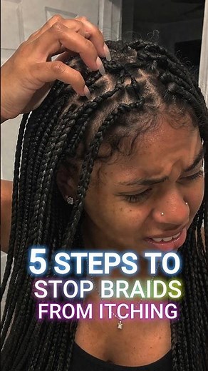 🚫 STOP ITCHING YOUR BRAIDS - DO THIS INSTEAD #boxbraids #blackhaircare