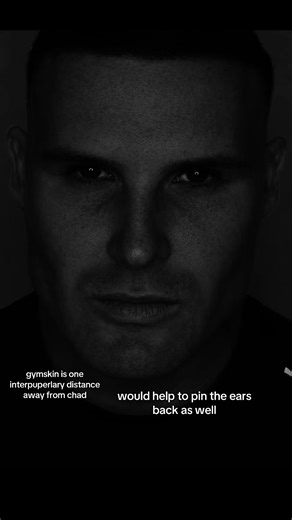 The Impact of Bone Structure on Facial Aesthetics