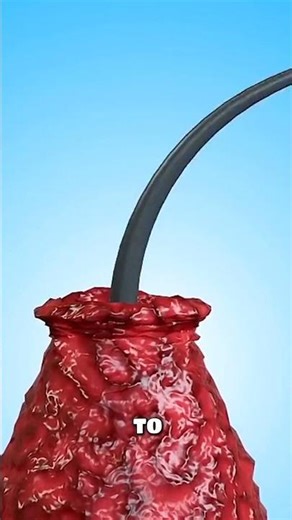 How Your Headphones Are Slowly Killing Your Hearing! 🎧🚫