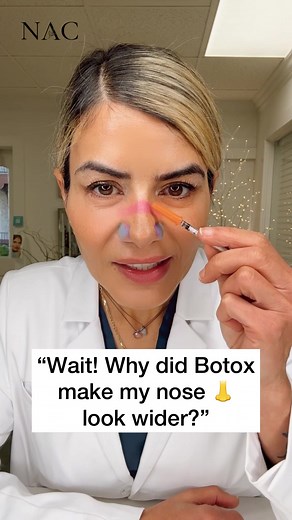 #nosebotox #noseslimming #widenose #botox #botoxtraining #drbitafarrell #naturalaestheticscenter