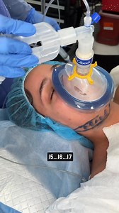Anesthesia Challenge #anesthesia #challenge #doctor #hospital #dentist | hat.gau6