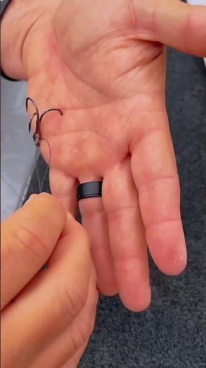 How To Remove A Hook (Deep In The Hand) #shorts