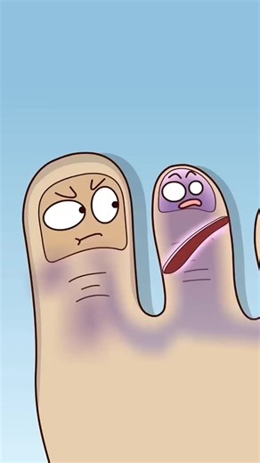 biomedical science on Instagram: "Why Doctors Are Putting Live Maggots on Patients . . Maggot Debridement Therapy (MDT) is an FDA-approved medical procedure that uses live, sterile maggots to clean non-healing wounds. The maggots perform three amazing tasks: they debride the wound by eating only the dead, infected tissue while leaving healthy tissue untouched; they disinfect by killing bacteria with their special secretions; and they stimulate healing by promoting the growth of new, healthy tiss