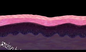 The Integumentary System: Nails