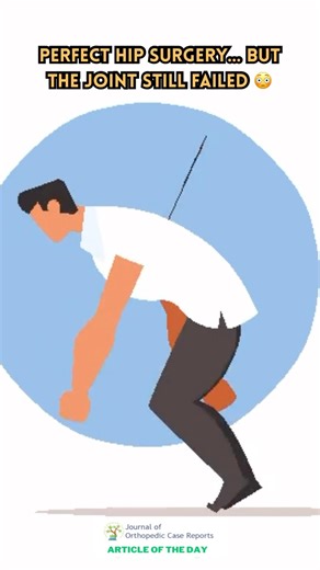 Perfect hip surgery… but the joint still failed 😳