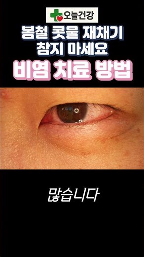 봄철 콧물 재채기 참지 마세요 🤧 알레르기 비염 치료 방법 | 시니어 건강 | 꽃가루 알레르기 | 1분 건강 #쇼츠