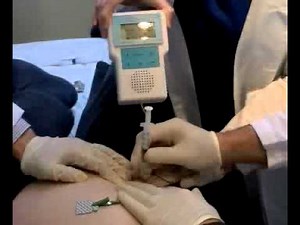 Myoguide Guided Piriformis Syndrome Injection