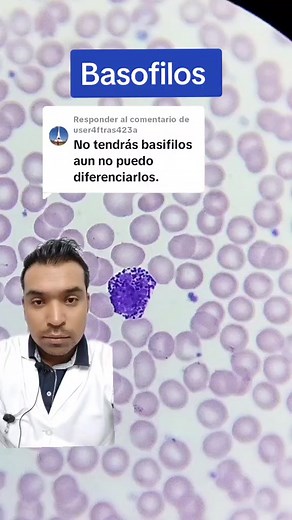 Understanding Basophils in Hematology with Microscope