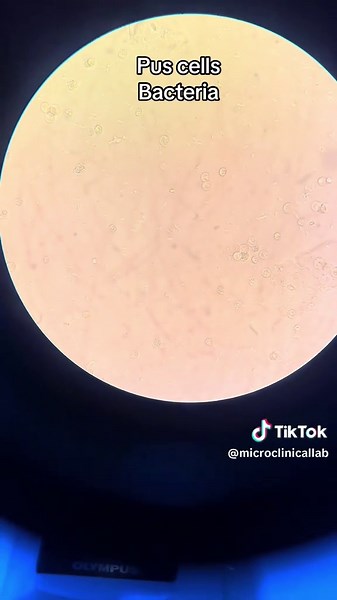 MICRO CLINICAL LAB & Xray ECG on TikTok