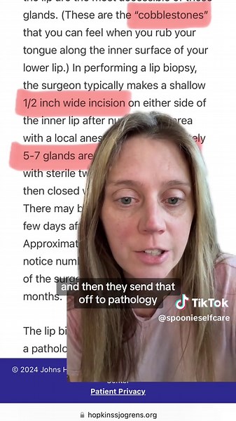 Replying to @lais the lip biopsy is a diagnostic tool that doctors used to help diagnose Sjogrens disease. This helps to explain what the lip biopsy is, and what the pathologist is looking for in order to help identify whether patient might have Sjogrens or not. They are looking for a small clumps or clusters within a certail area and this gives them a focal score. ##sjogrenslipbiopsy##sjogrensawareness2024##sjogrensdiagnosis##sjogrensdisease #greenscreen