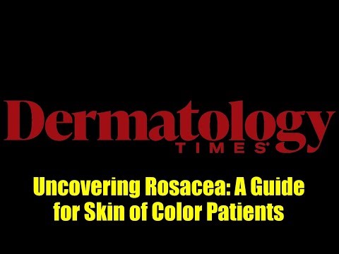 Uncovering Rosacea: A Guide for Skin of Color Patients