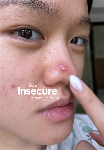 Wardah Serum Microneedle untuk Perbaikan Kulit