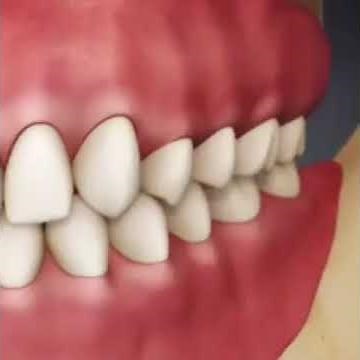 The best way to Brush your teeth | Modified Bass Brushing Technique #dentalhygiene #brushingteeth