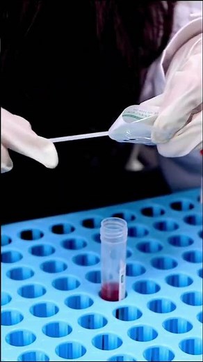 Disposable sampling swab is mainly used to collect samples of cells, viruses and microorganisms.