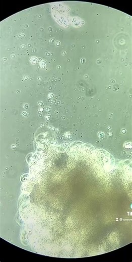 Bedside water under the microscope!