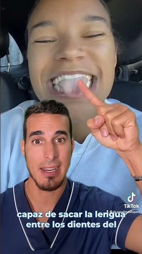 😲This is how her MOUTH looks after SUCKING her THUMB - THUMB SUCKING and OPEN BITE