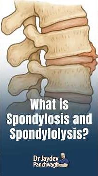 What is Spondylosis and Spondylolysis?