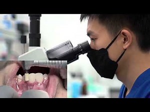 What Expect!😮Professional Teeth Cleaning A Dentist's Step-by-Step #004