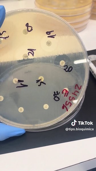 Interpretación del antibiograma: Proceso y Registro detallado