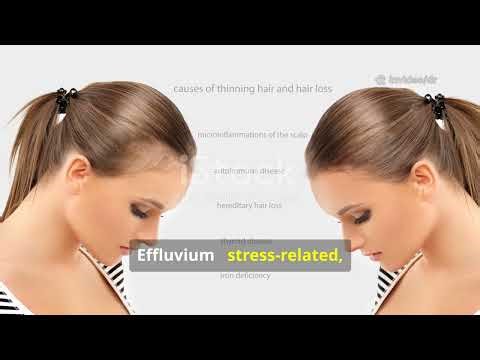 Hair Loss (Alopecia): Early Signs, Causes & What Really Works