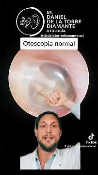 OTOSCOPIA NORMAL - ¿Cómo ver un oído?