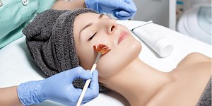 Chemical Peel Treatment Cost In India – 2025 Price Analysis