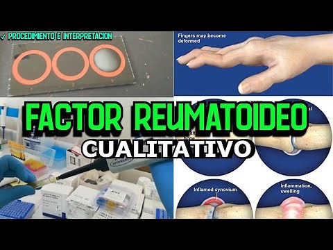 Análisis Cualitativo del Factor Reumatoideo: Guía Práctica en Placa
