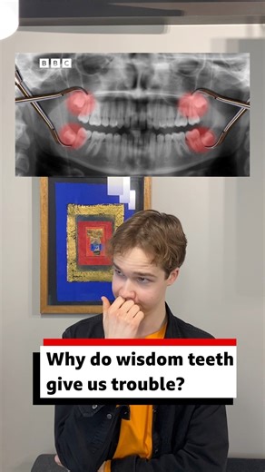 6.1K views · 78 reactions | Why do we have wisdom teeth? 醴 Wisdom...