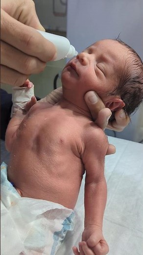 Correct Way to Use Saline Drops for Blocked Nose💧❤️ #newborncare #newborncare #baby #baby #feeding