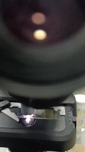 Stool sample 😲😍🔬. At least 3 parasites in this stool sample ❤️🔬❤️. #lablife #microbiology #medicallaboratoryscience | Lab life